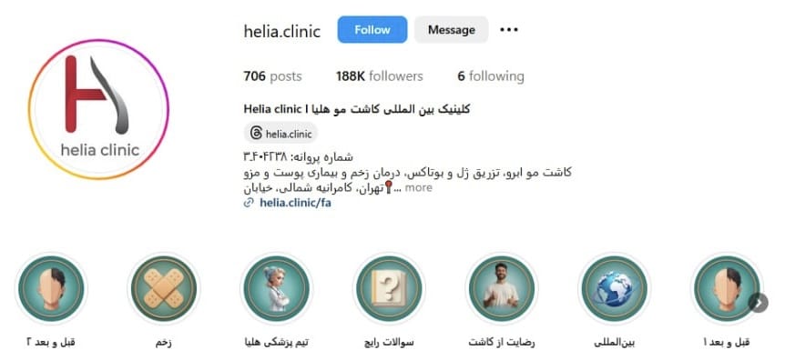 بهترین مراکز لیپوماتیک در تهران